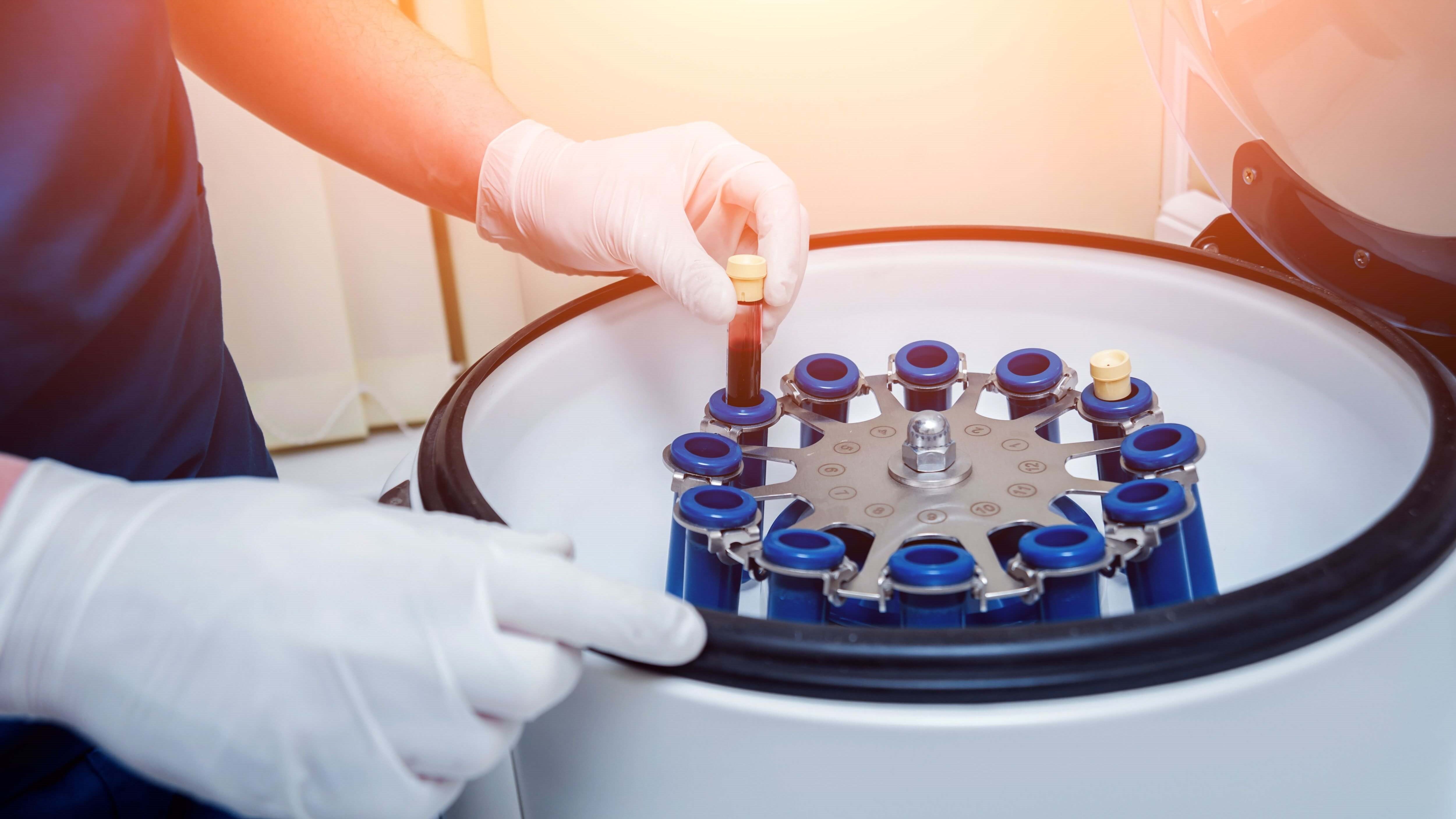 Tissue Regeneration